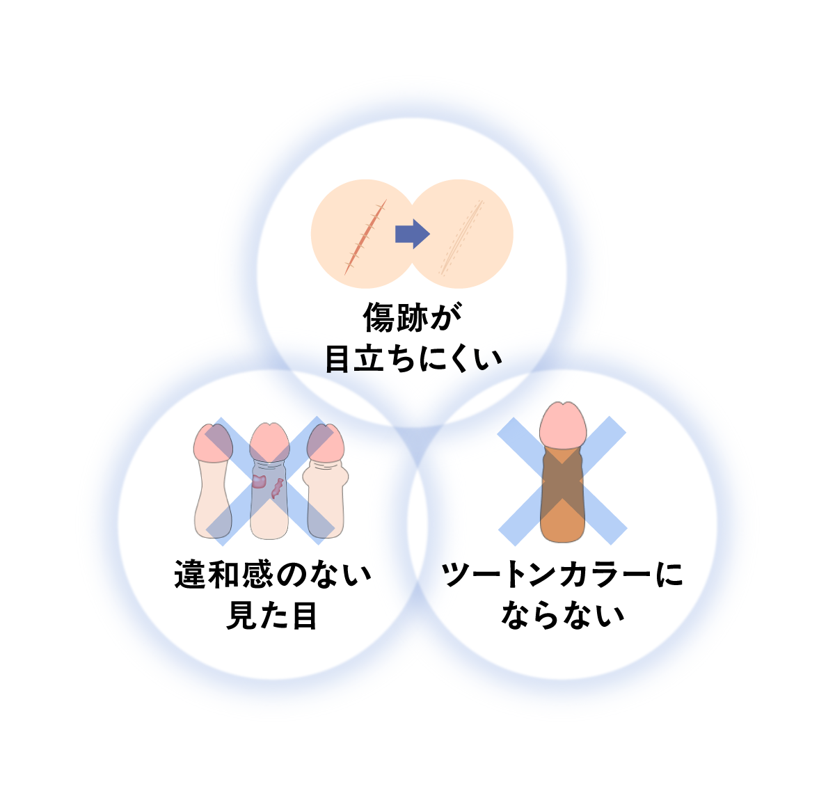 傷跡が目立ちにくい、ツートンカラーにならない、違和感がない